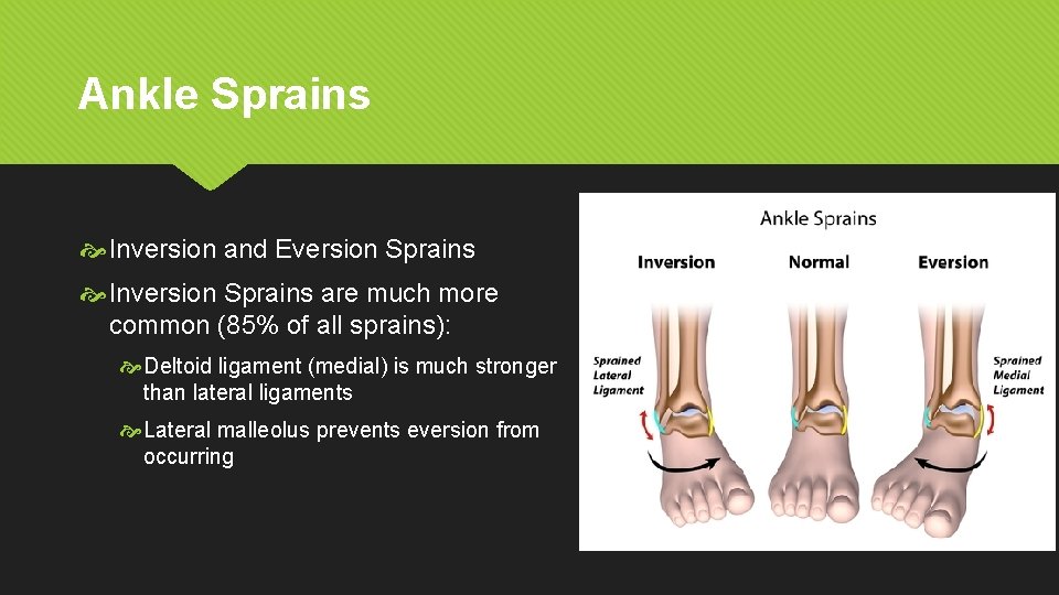 Ankle Sprains Inversion and Eversion Sprains Inversion Sprains are much more common (85% of