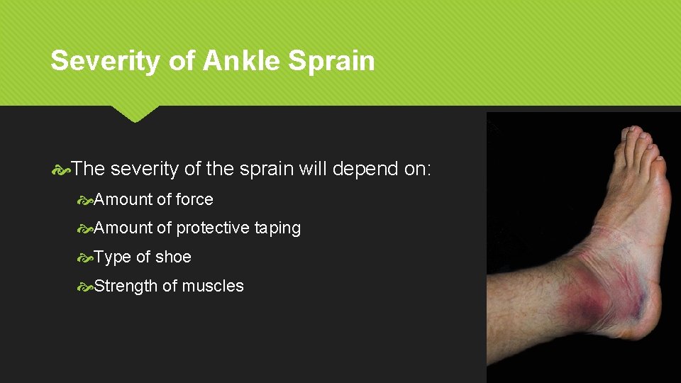 Severity of Ankle Sprain The severity of the sprain will depend on: Amount of