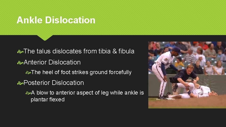 Ankle Dislocation The talus dislocates from tibia & fibula Anterior Dislocation The heel of