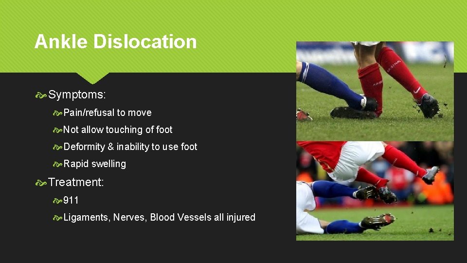 Ankle Dislocation Symptoms: Pain/refusal to move Not allow touching of foot Deformity & inability