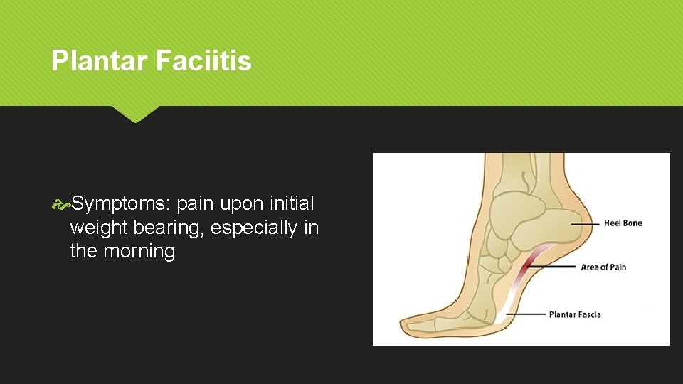Plantar Faciitis Symptoms: pain upon initial weight bearing, especially in the morning 