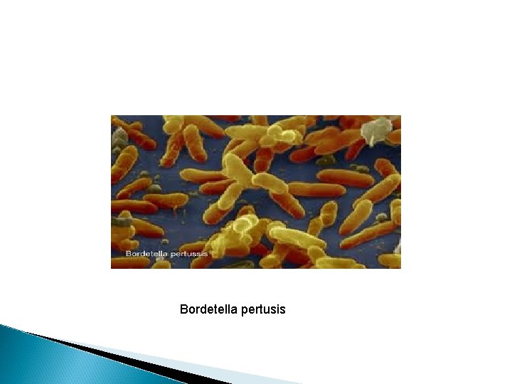 Bordetella pertusis Bordetella pertusis