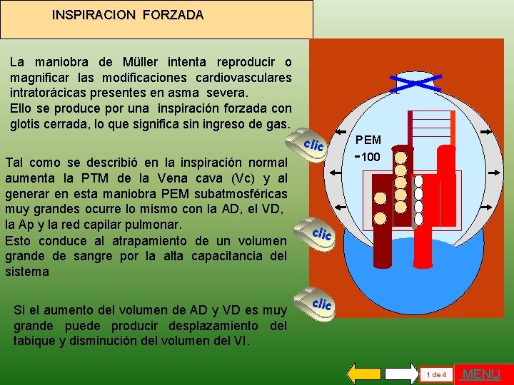 INSPIRACION FORZADA La maniobra de Müller intenta reproducir o magnificar las modificaciones cardiovasculares intratorácicas