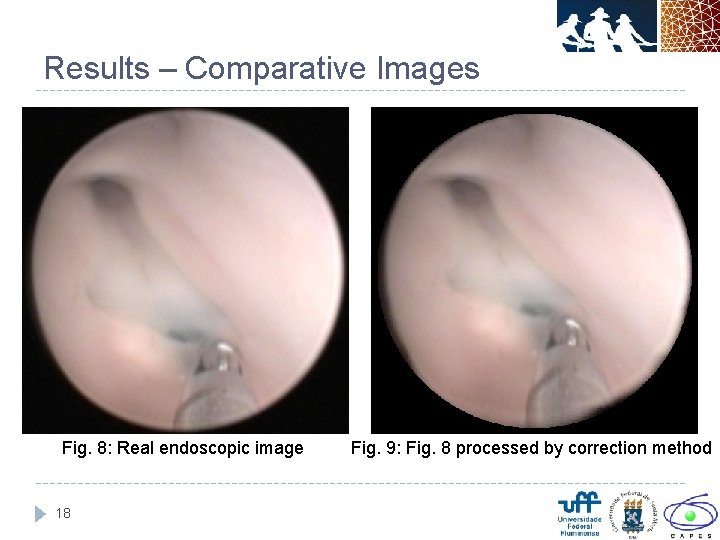 Results – Comparative Images Fig. 8: Real endoscopic image 18 Fig. 9: Fig. 8