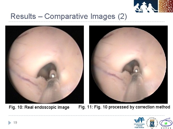Results – Comparative Images (2) Fig. 10: Real endoscopic image 19 Fig. 11: Fig.