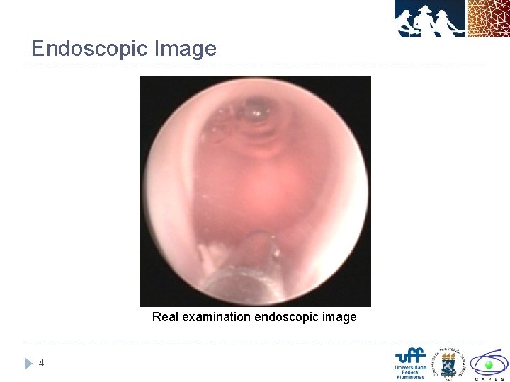 Endoscopic Image Real examination endoscopic image 4 