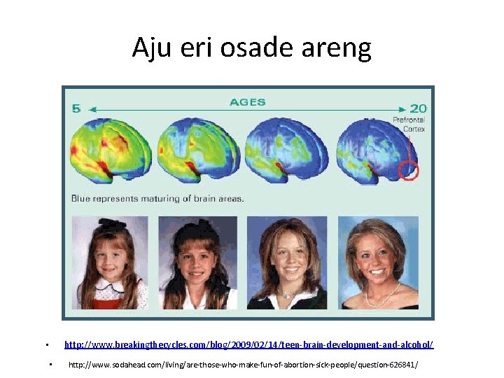 Aju eri osade areng http: //www. breakingthecycles. com/blog/2009/02/14/teen-brain-development-and-alcohol/ • • http: //www. sodahead. com/living/are-those-who-make-fun-of-abortion-sick-people/question-626841/