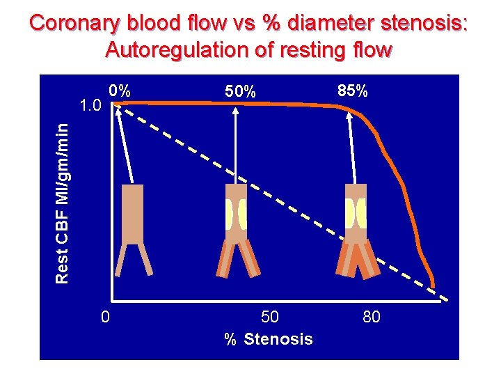 Coronary blood flow vs % diameter stenosis: Autoregulation of resting flow 50% 85% Rest