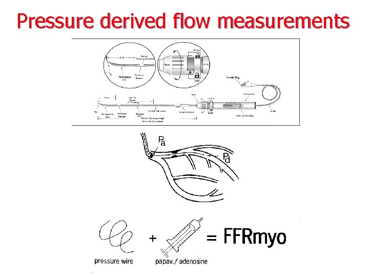 Pressure derived flow measurements 