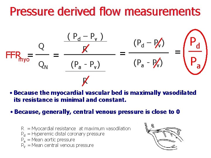 Pressure derived flow measurements FFRmyo= Q QN ( Pd – P v ) =