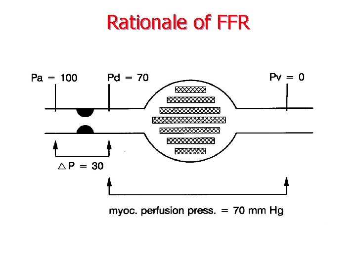 Rationale of FFR 