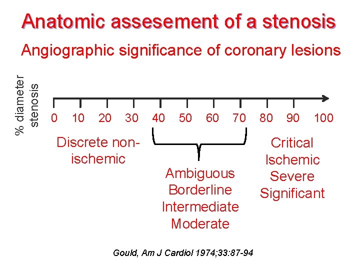 Anatomic assesement of a stenosis % diameter stenosis Angiographic significance of coronary lesions 0
