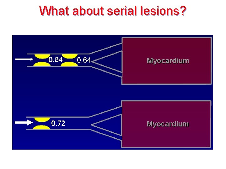 What about serial lesions? 