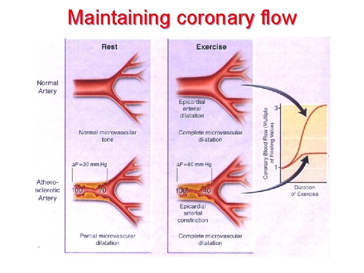 Maintaining coronary flow 
