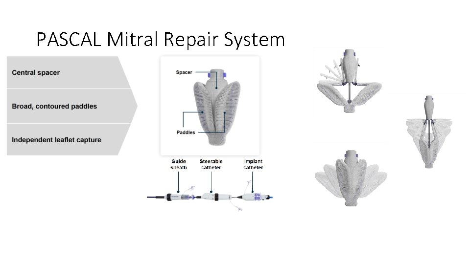 PASCAL Mitral Repair System 