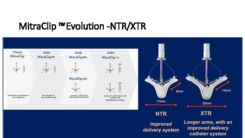 Mitra. Clip™ Evolution -NTR/XTR 