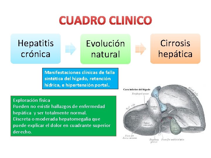 CUADRO CLINICO Hepatitis crónica Evolución natural Manifestaciones clínicas de falla sintética del hígado, retención