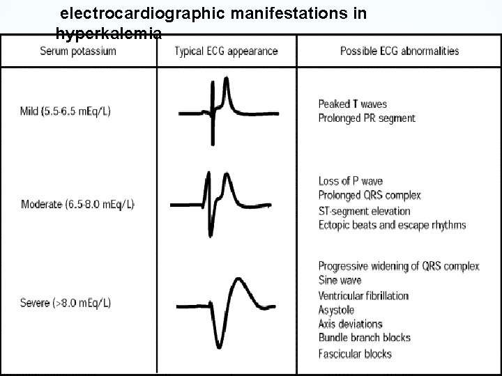 electrocardiographic manifestations in hyperkalemia 