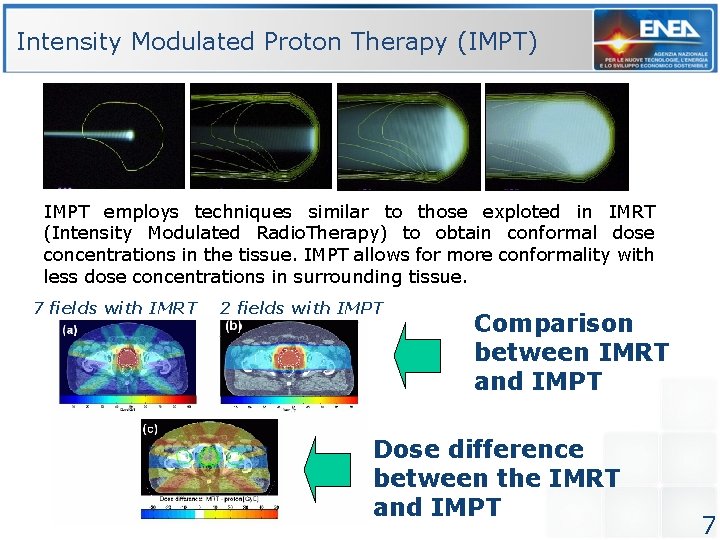 Intensity Modulated Proton Therapy (IMPT) IMPT employs techniques similar to those exploted in IMRT Intensity Modulated Proton Therapy (IMPT) IMPT employs techniques similar to those exploted in IMRT