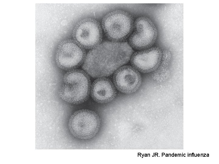 Ryan JR. Pandemic influenza 