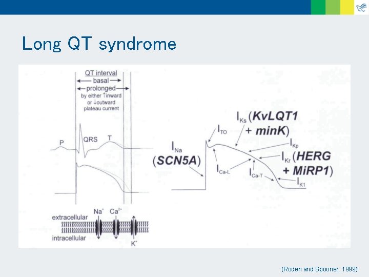 Long QT syndrome (Roden and Spooner, 1999) 