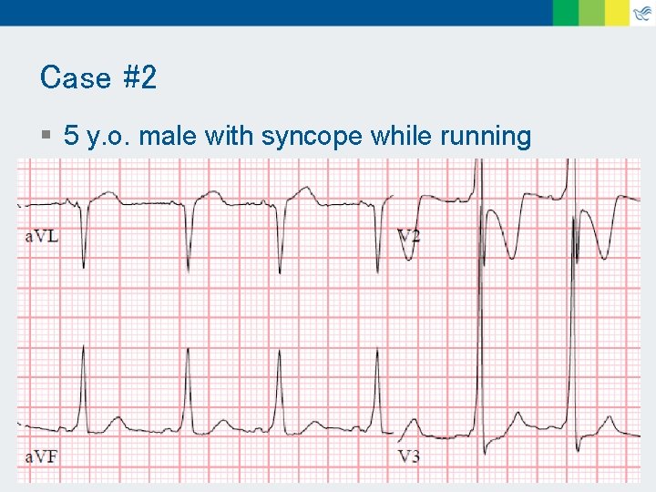 Case #2 § 5 y. o. male with syncope while running 