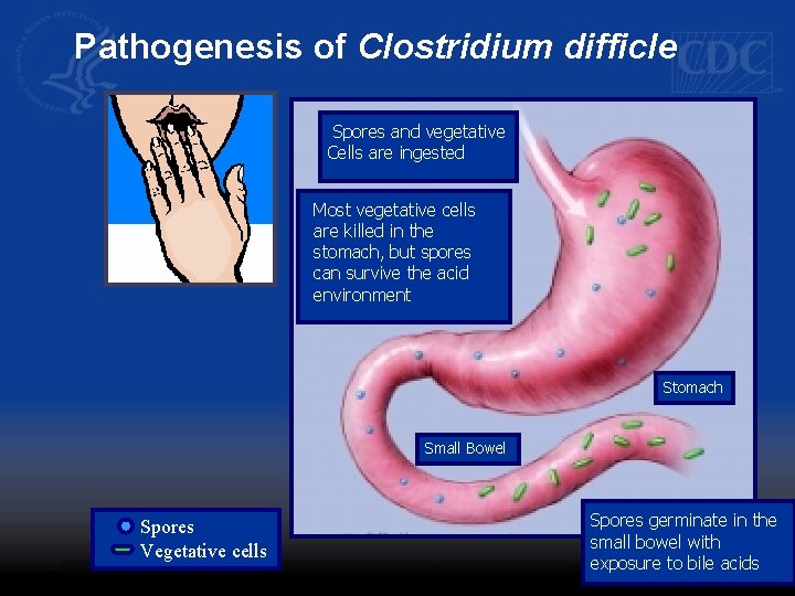 Pathogenesis of Clostridium difficle Spores and vegetative Cells are ingested Most vegetative cells are