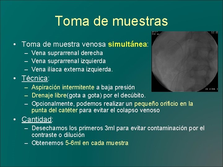 Toma de muestras • Toma de muestra venosa simultánea: – Vena suprarrenal derecha –