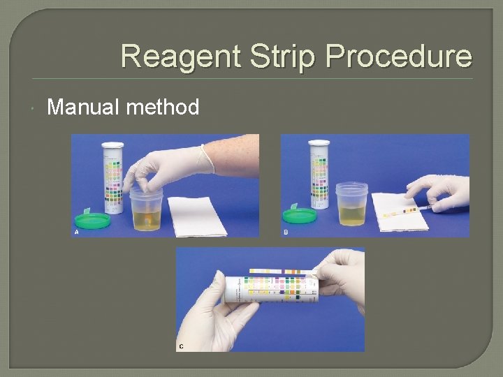 Reagent Strip Procedure Manual method 