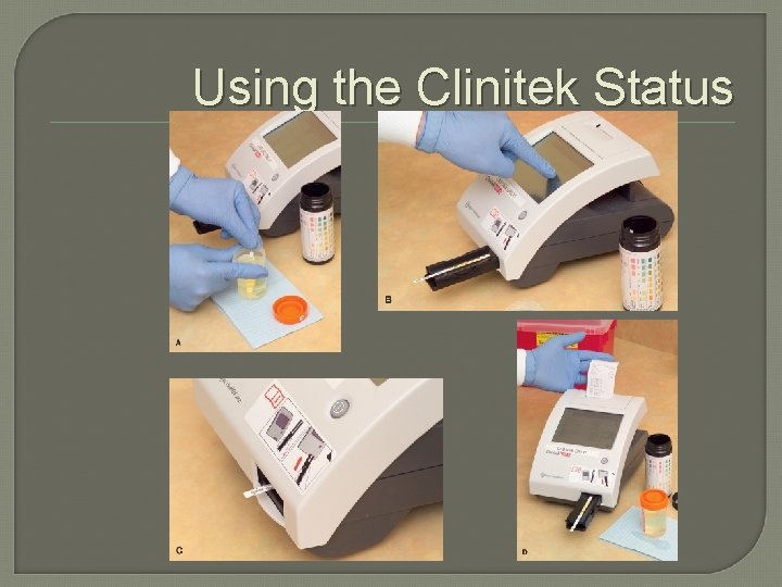 Using the Clinitek Status 