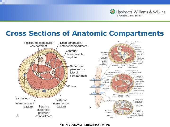 Cross Sections of Anatomic Compartments Copyright © 2008 Lippincott Williams & Wilkins. 