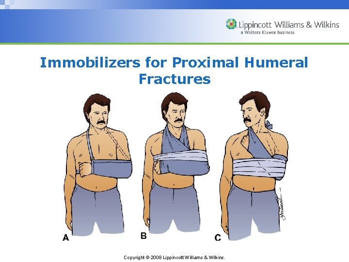Immobilizers for Proximal Humeral Fractures Copyright © 2008 Lippincott Williams & Wilkins. 