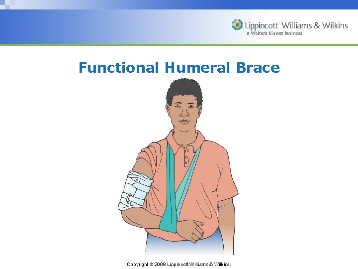 Functional Humeral Brace Copyright © 2008 Lippincott Williams & Wilkins. 