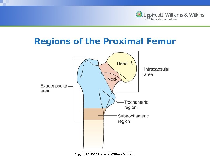 Regions of the Proximal Femur Copyright © 2008 Lippincott Williams & Wilkins. 