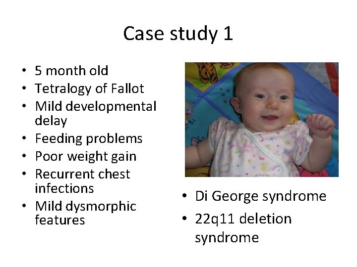 Case study 1 • 5 month old • Tetralogy of Fallot • Mild developmental