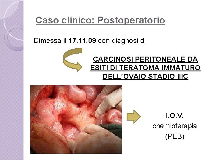 Caso clinico: Postoperatorio Dimessa il 17. 11. 09 con diagnosi di CARCINOSI PERITONEALE DA