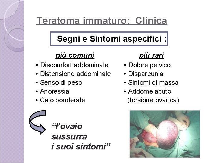 Teratoma immaturo: Clinica Segni e Sintomi aspecifici : più comuni più rari • Discomfort