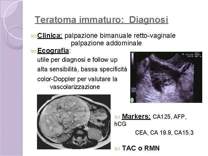 Teratoma immaturo: Diagnosi Clinica: palpazione bimanuale retto-vaginale palpazione addominale Ecografia: utile per diagnosi e