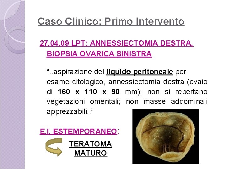 Caso Clinico: Primo Intervento 27. 04. 09 LPT: ANNESSIECTOMIA DESTRA, BIOPSIA OVARICA SINISTRA “.