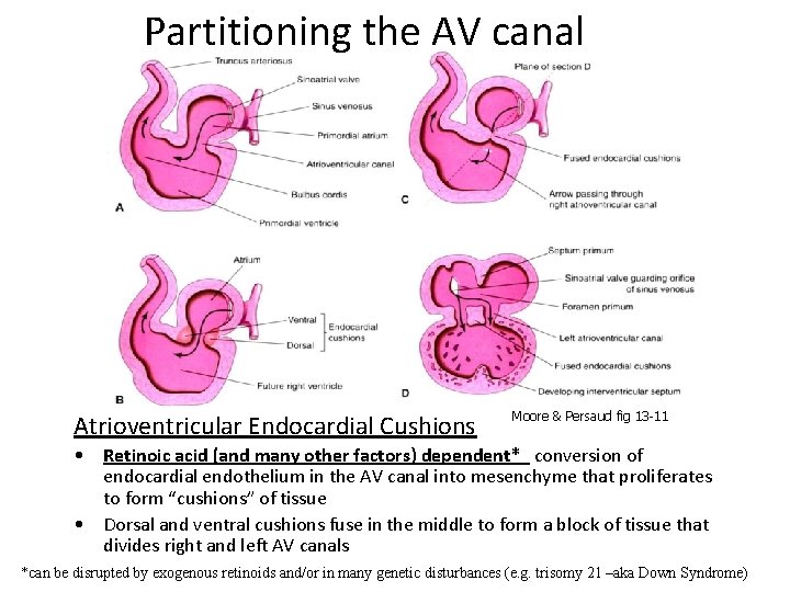 Partitioning the AV canal Atrioventricular Endocardial Cushions Moore & Persaud fig 13 -11 •