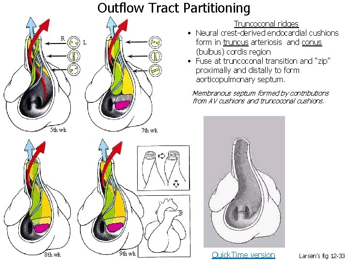 Outflow Tract Partitioning R Truncoconal ridges • Neural crest-derived endocardial cushions form in truncus