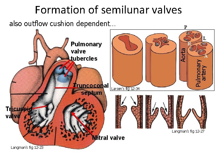 Formation of semilunar valves Pulmonary valve tubercles Truncoconal septum P Aorta R Larsen’s fig