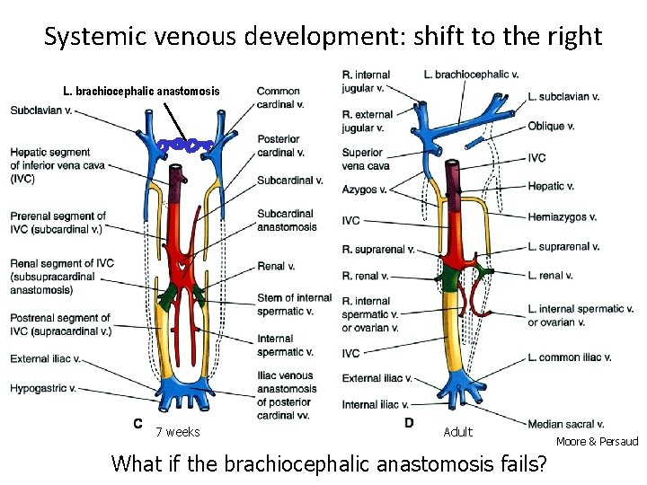 Systemic venous development: shift to the right L. brachiocephalic anastomosis 7 weeks Adult What