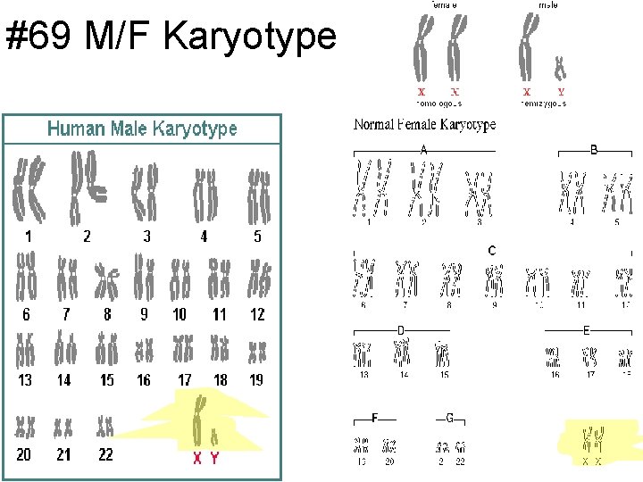 #69 M/F Karyotype 