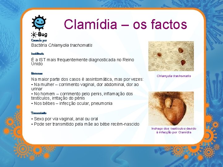 Clamídia – os factos Causada por Bactéria Chlamydia trachomatis Incidência É a IST mais