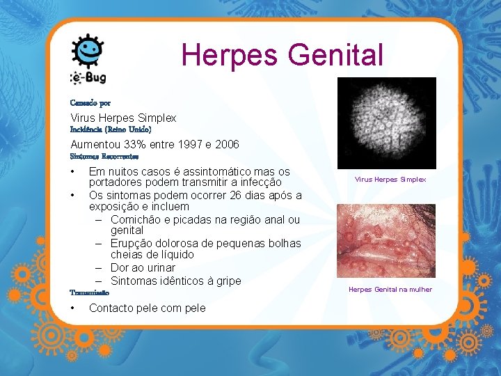 Herpes Genital Causado por Virus Herpes Simplex Incidência (Reino Unido) Aumentou 33% entre 1997