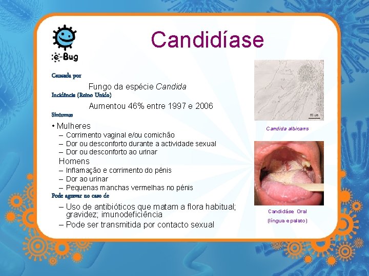 Candidíase Causada por Fungo da espécie Candida Incidência (Reino Unido) Aumentou 46% entre 1997