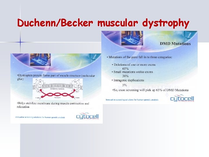 Duchenn/Becker muscular dystrophy 