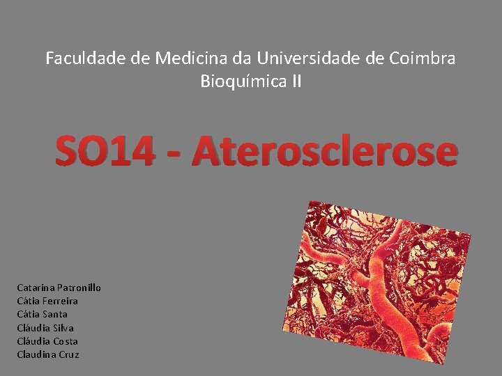 Faculdade de Medicina da Universidade de Coimbra Bioquímica II SO 14 - Aterosclerose Catarina