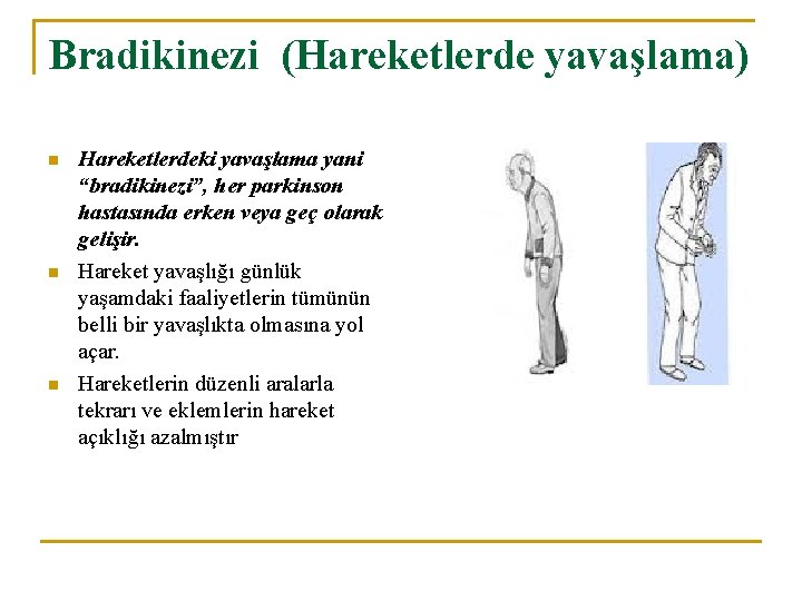 Bradikinezi (Hareketlerde yavaşlama) n n n Hareketlerdeki yavaşlama yani “bradikinezi”, her parkinson hastasında erken